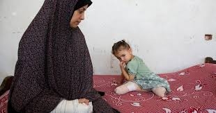 أكثر من 6500 حالة بتر في غزة منذ بدء جريمة الإبادة