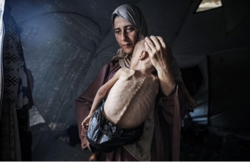 استشهاد خمسة فلسطينيين بسبب المجاعة في غزة خلال الـ24 الساعة الماضية