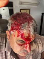 استشهاد 3 فلسطينيين وإصابة 8 آخرين في هجمات لمستوطنين صهاينة في الضفة الغربية