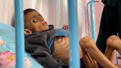 وفاة طفل فلسطيني في خان يونس نتيجة المجاعة وسوء التغذية