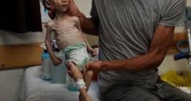 يونيسف: غزة تجاوزت عتبة المجاعة.. والوضع الإنساني صادم 