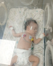 حرب الإبادة على غزة تخنق أنفاس الرضيعة "ألمى".. والعلاج مؤجل خلف المعابر