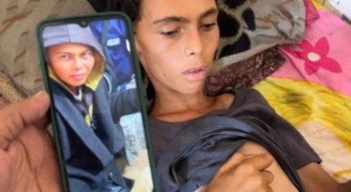 استشهاد فتى فلسطيني بسبب الجوع وسوء التغذية بغزة