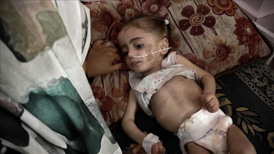 مريم.. قصة جسدٍ صغير يدفعه تجويع العدو الصهيوني للموت البطيء