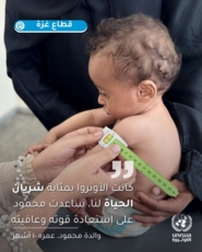 "أونروا": مستويات سوء التغذية المرتفعة تُهدد حياة الأطفال في قطاع ‎غزة