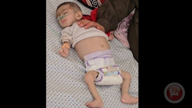 استشهاد طفلة فلسطينية في غزة بسبب المجاعة ما يرفع الحصيلة إلى 54