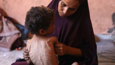 وفاة 4 حالات بينها طفل بسبب المجاعة في غزة