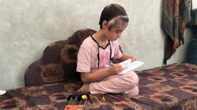 طفلة من غزة عالقة بين الألم والمعابر.. وقطعة من رأسها تنتظر العودة