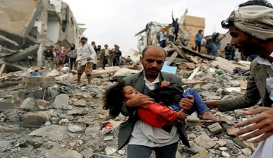 اليمنيون لا يحتاجون إلى مؤتمر لجمع التبرعات، إنهم بحاجة إلى إنهاء الحرب