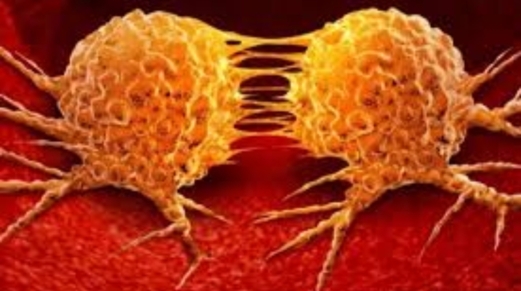 فريق من الباحثين في بريطانيا يتوصل إلى تقنية جديدة لتشخيص أورام الدماغ