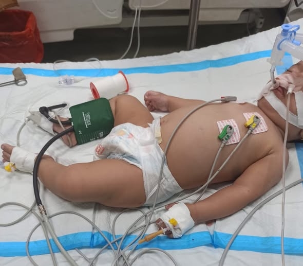 أبو سلمية : القطاع الصحي لم يشهد أي تحسن منذ إعلان وقف الحرب في غزة