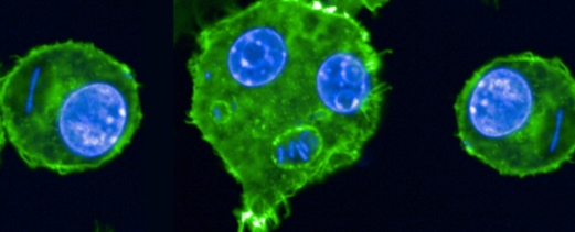 دراسة تكشف عن قدرة الطاعون على النجاة من ثلاثة أوبئة