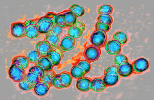 داء الفيالقة يحصد ضحيته الخامسة في نيويورك