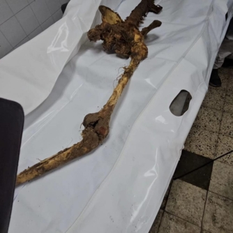 الادلة الجنائية: وضع الجثامين التي سلمها العدو الصهيوني لا تسمح بالتعرف عليها