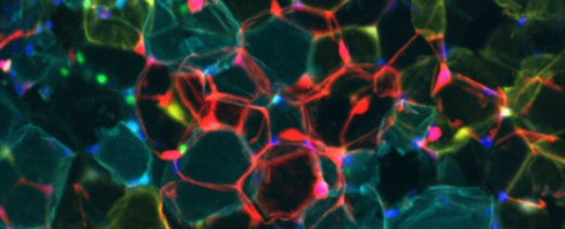 دراسة تكشف مفتاحًا خفيًا يجعل الدهون تحرق السعرات الحرارية