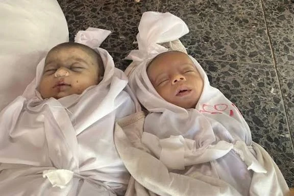 الصحة بغزة: 1500 طفل ينتظرون السفر للعلاج و110 آلاف يعانون سوء التغذية