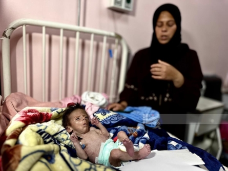 استشهاد ثالث رضيع في غزة يرفع عدد الشهداء بسوء التغذية والمجاعة إلى 5 خلال 24 ساعة