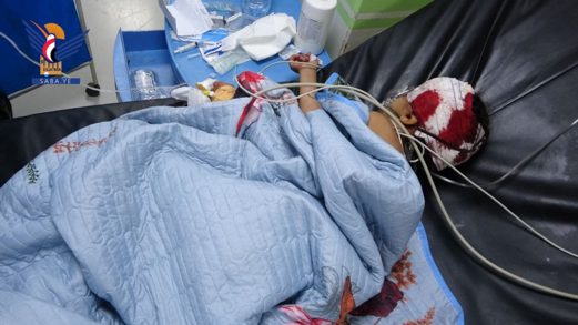 الضالع.. إصابة طفلة برصاص قناص تابع لمرتزقة العدوان في قعطبة