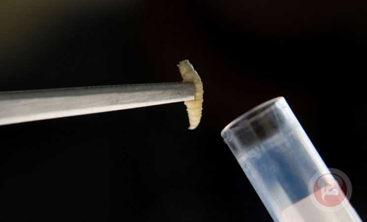 وزارة الصحة الامريكية تؤكد أول إصابة بشرية بداء "الدودة الحلزونية"