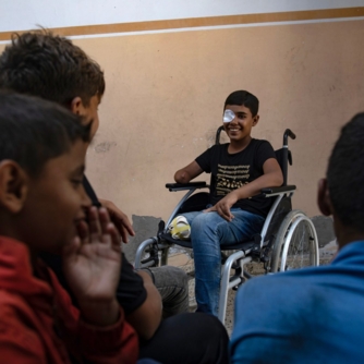 البرش: البتر أصبح خيارا وحيدا لأطباء غزة لإنقاذ المصابين