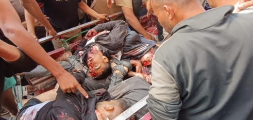 وزارة الصحة بغزة: 45 شهيداً ومئات المصابين في مجزرة بحق منتظري المساعدات