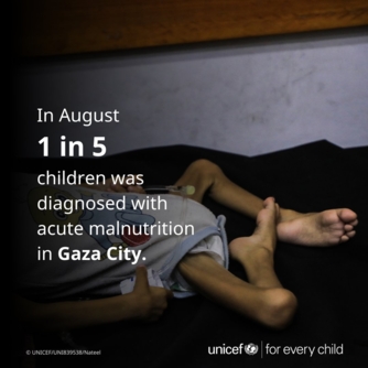 "يونيسف": ارتفاع معدل سوء التغذية الحاد بين الأطفال في غزة إلى مستوى قياسي