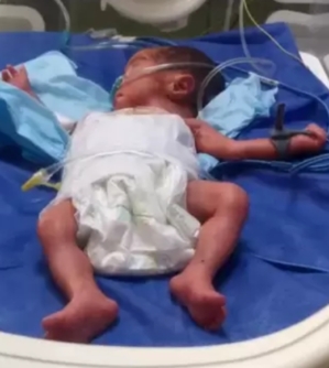 رآها دقائق وفقدها شهورًا..حكاية أب وطفلته خديجة تحت نار غزة