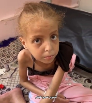 تحت أنظار الإنسانية.. العدو الصهيوني يُمعن باغتيال الطفولة في غزة