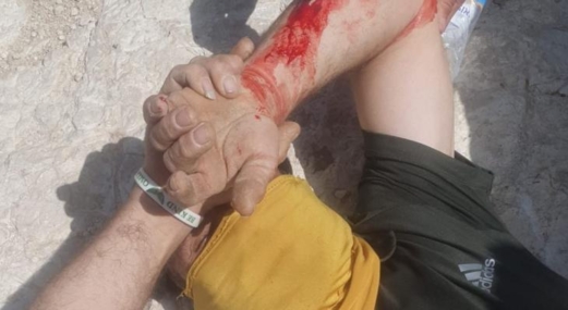 إصابات في هجوم للمستوطنين في مسافر يطا