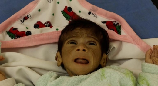 أطباء بلا حدود: التجويع يفاقم سوء التغذية لأطفال غزة ولم نشهد كارثة إنسانية بهذا الحجم من قبل