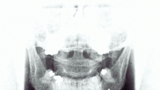 علماء روس يحسنون "الرؤية" في أجهزة الأشعة السينية