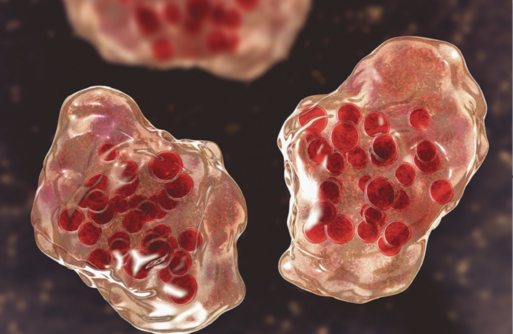 مرض الحصبة يضرب مدينة أمريكية كبرى ويهدد الملايين