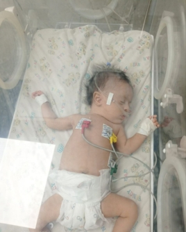 حرب الإبادة على غزة تخنق أنفاس الرضيعة "ألمى".. والعلاج مؤجل خلف المعابر