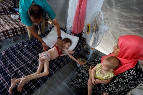 المنظمات الأهلية": 200 ألف طفل بغزَّة يعانون سوء تغذية حاد