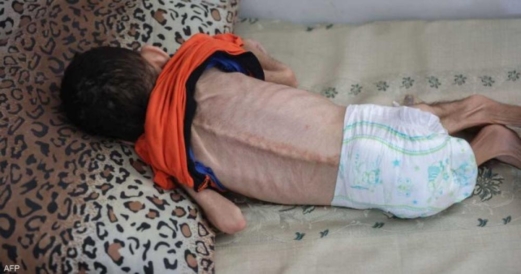 الأمم المتحدة تطالب بعمل دولي عاجل لوقف الوفيات في غزة