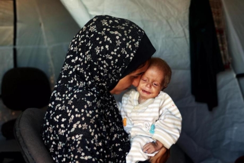 الصحة العالمية: 90 من حوامل ومرضعات غزة يعانين من سوء تغذية حاد