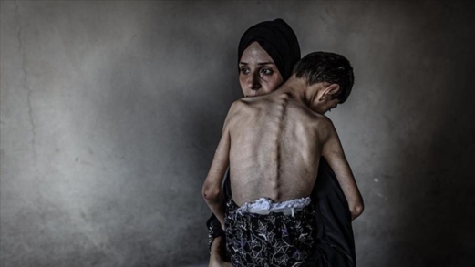 مسؤول أممي يدعو لإجراءات عاجلة حيال المجاعة في غزة