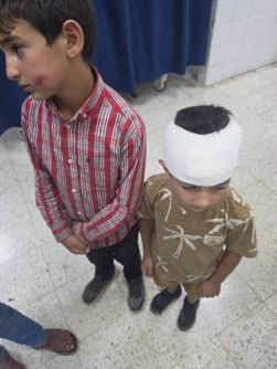 إصابة طفلين فلسطينيين من اللبن الشرقية إثر اعتداء لمستوطنين شرق سلفيت