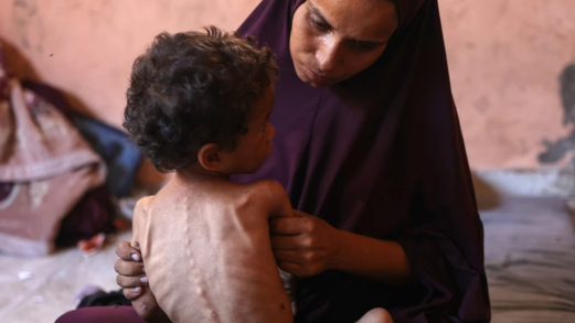 وفاة 4 حالات بينها طفل بسبب المجاعة في غزة