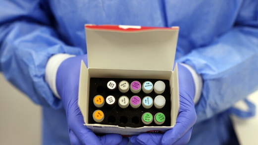 بدء اختبارات اللقاح الهجين بين “سبوتنيك V” و”أسترا زينيكا”