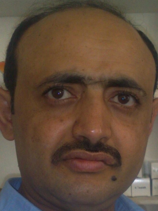 عن الحل في اليمن