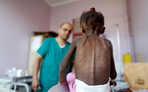 اليمن: يجب أن تكون هذه الصور بمثابة صاعقة كهربائية