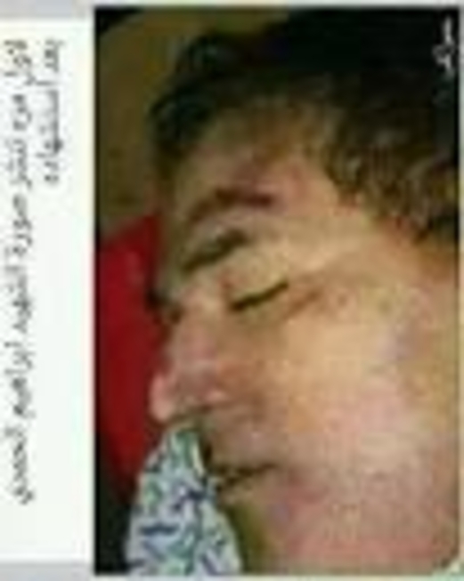 تفاصيل لم تنشر عن اغتيال الرئيس الشهيد ابراهيم الحمدي (الحلقة العاشرة)