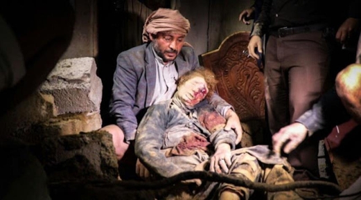 النفاق العالمي والإعلامي في حرب اليمن..!