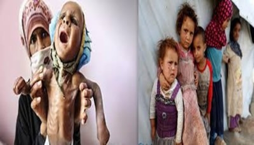 خمس منظمات إغاثية تدعو واشنطن لإنهاء دعمها للعدوان على اليمن