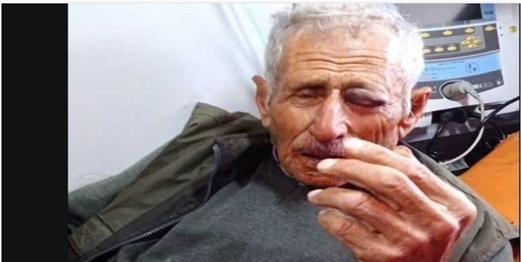 إصابة مسن فلسطيني جراء اعتداء مستوطنين عليه في طولكرم