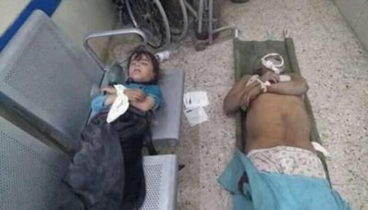 24 شهيدا وجريحا جلهم أطفال ونساء حصيلة جريمة العدوان بالضالع