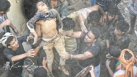 وزارة الصحة: 77 شهيداً وجريحاُ حصيلة غارات طيران العدوان بالعاصمة صنعاء
