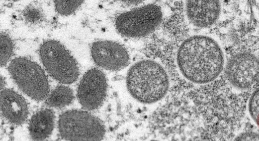 تسجيل اول حالة وفاة بمرض ألاسكابوكس في ولاية الاسكا الاميركية