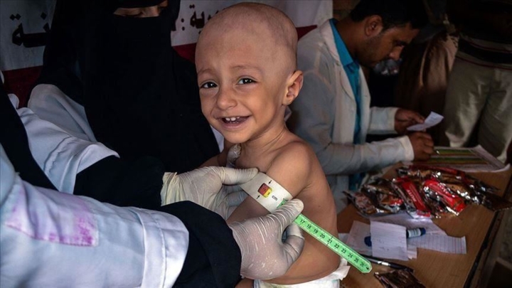 انعدام الدواء بسبب الحصار ​يفاقم معاناة أطفال "الثلاسيميا​"